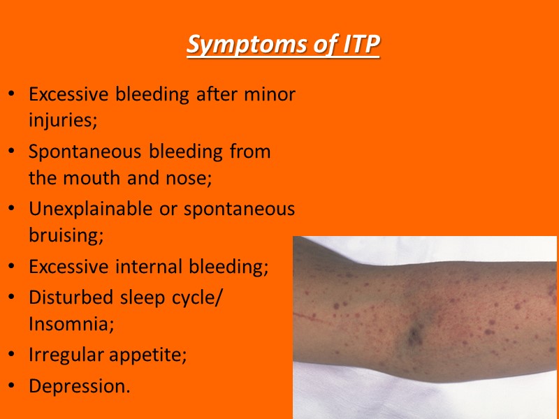 Symptoms of ITP  Excessive bleeding after minor injuries; Spontaneous bleeding from the mouth